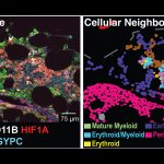 CODEX Image and Cellular Neighborhood of Bone Marrow