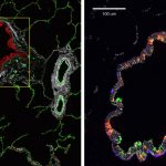 CODEX Images of Bronchiole and Vasculature