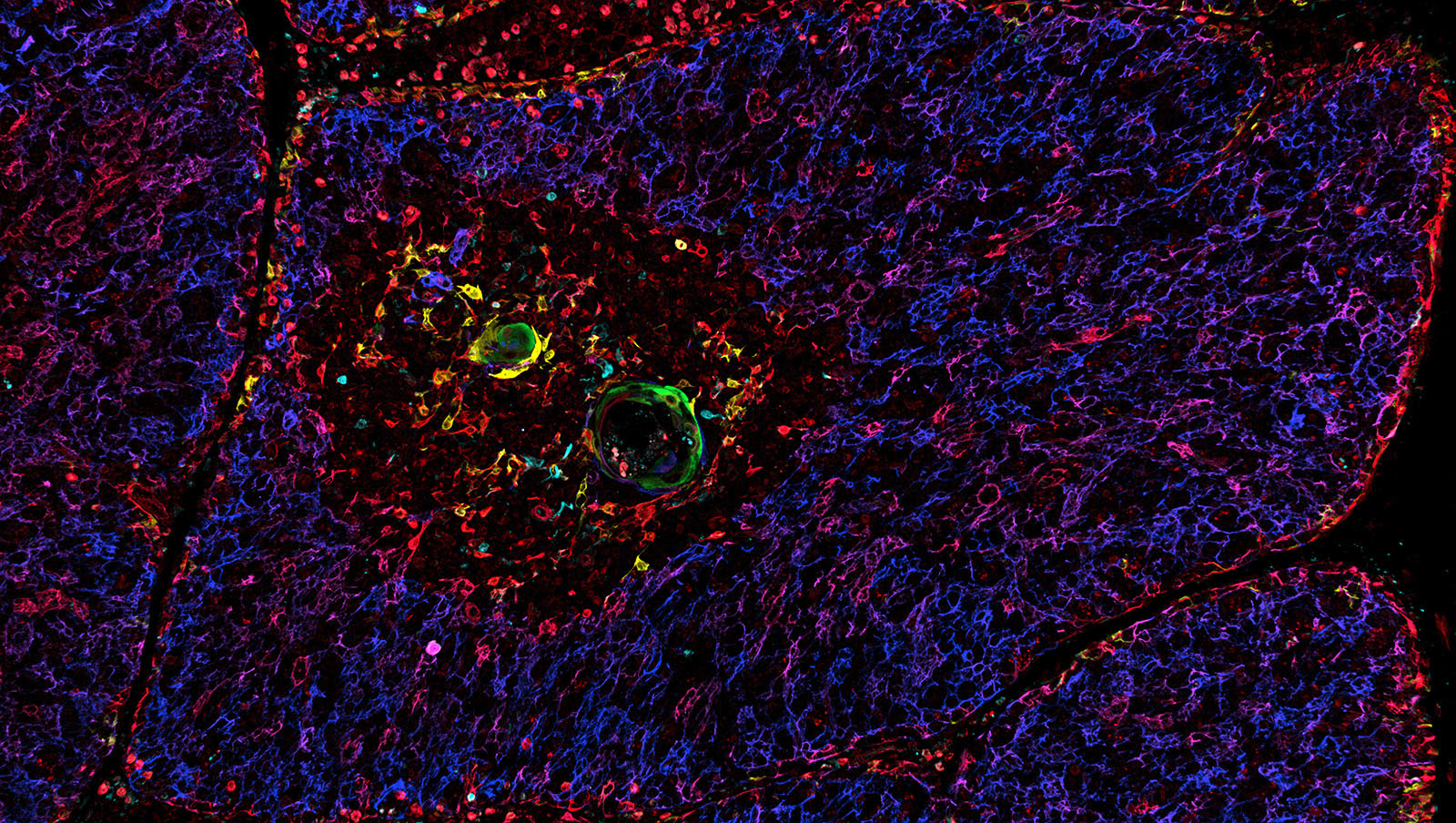 IBEX Image of a Thymus