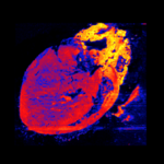 Metabolomics Image of a Mouse Heart