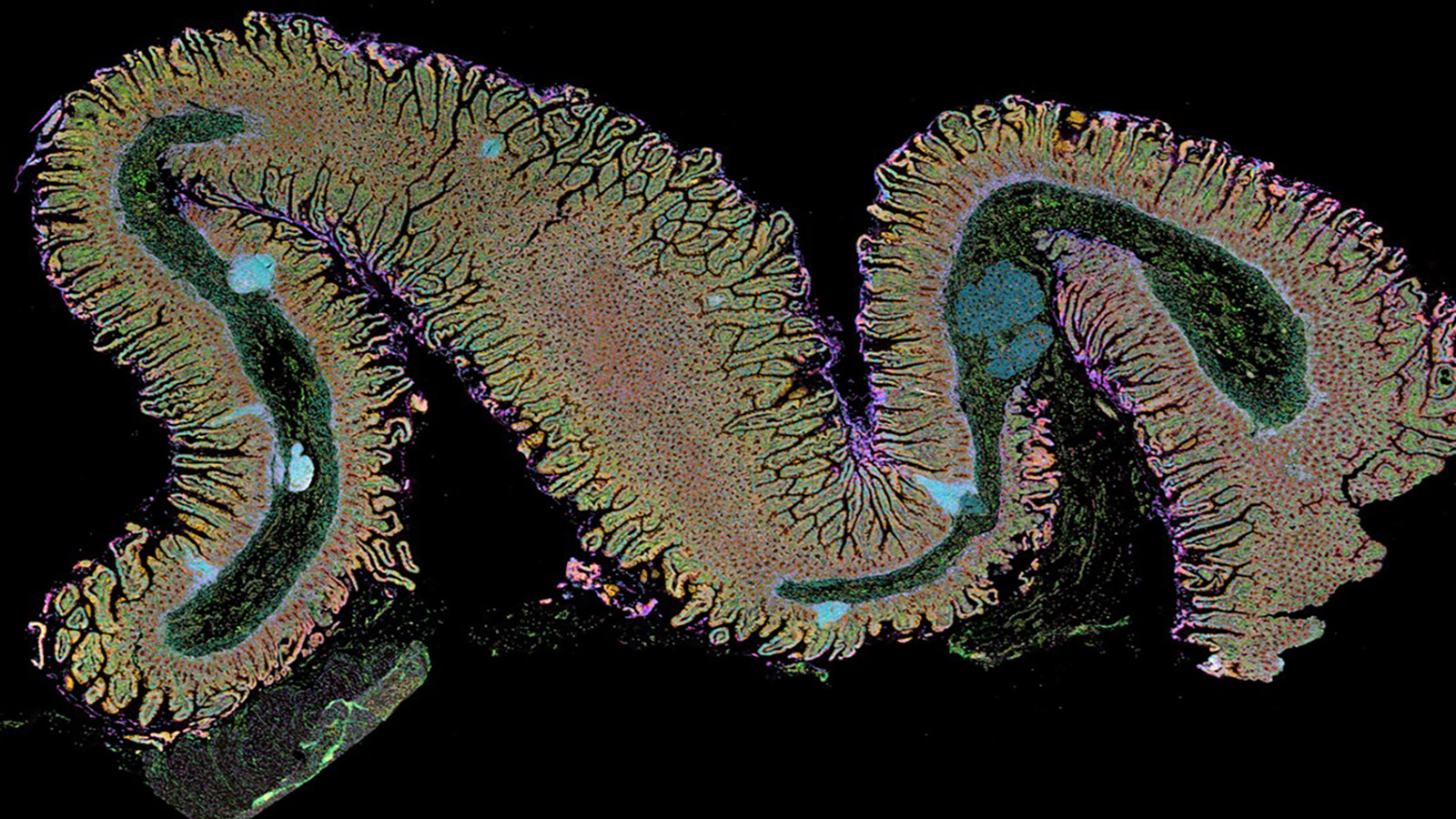 Xenium 5k Image of the Duodenum Region of the Small Intestine