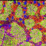 MALDI and Microscopy Lipid Atlas of the Human Kidney